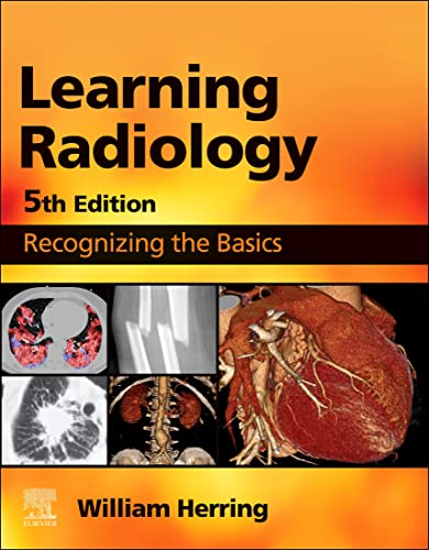 LEARNING RADIOLOGY RECOGNIZING THE BASICS 2024 - رادیولوژی